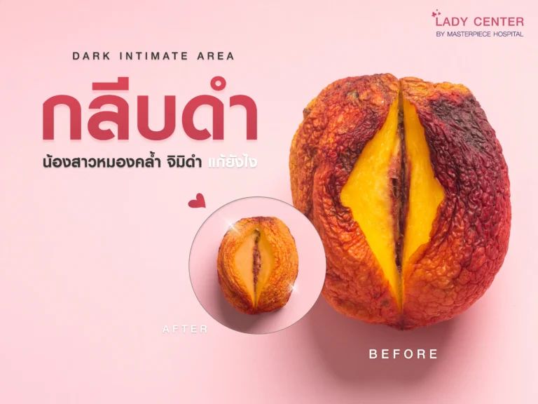 กลีบดำเกิดจากอะไร น้องสาวหมองคล้ำ จิมิดำ แก้ยังไง รักษาอย่างไร ?