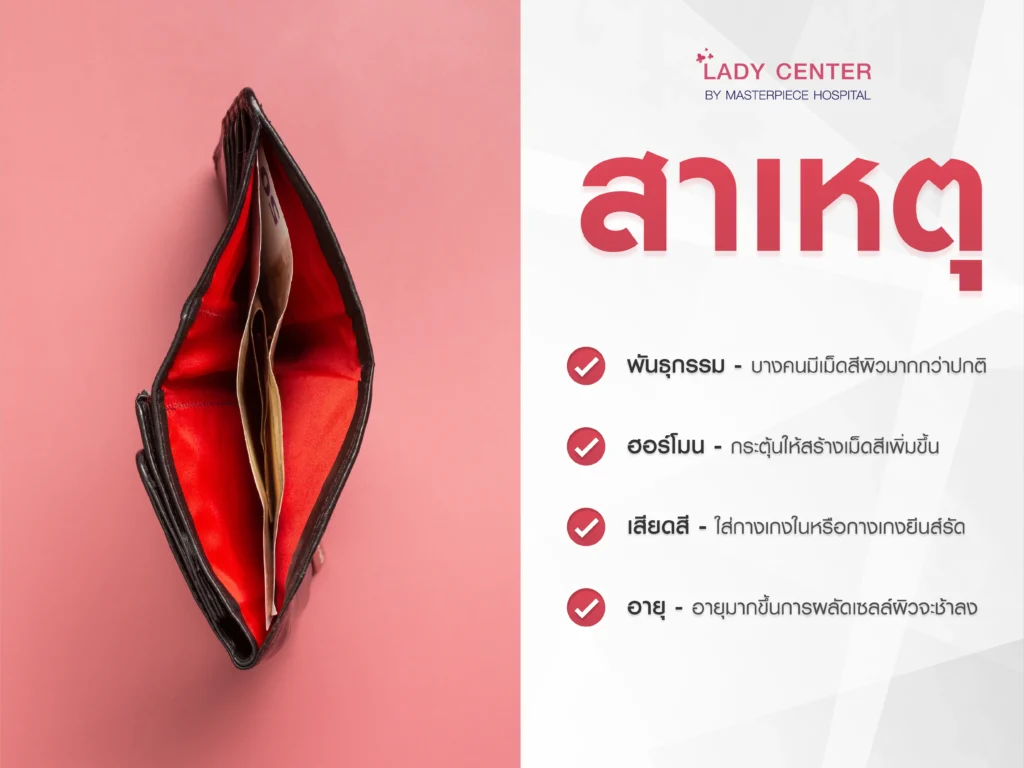 สาเหตุของน้องสาวกลีบดำ จิมิมีสีหมองคล้ำ