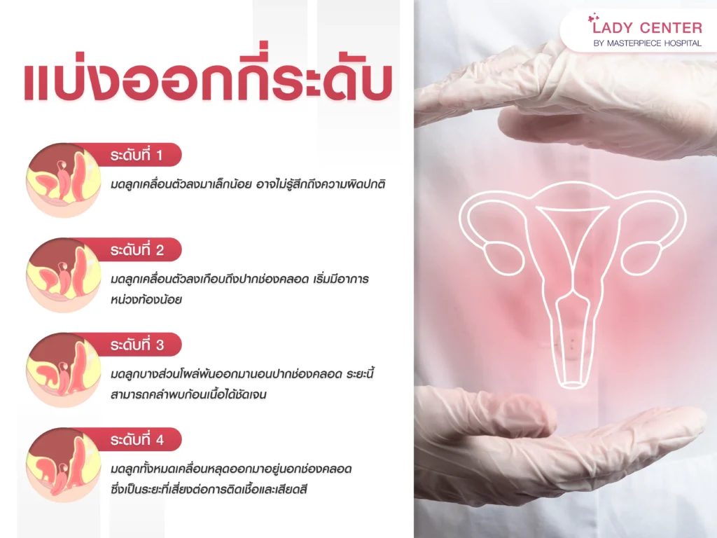 ภาวะมดลูกหย่อน มดลูกต่ำ แบ่งออกเป็นกี่ระดับ